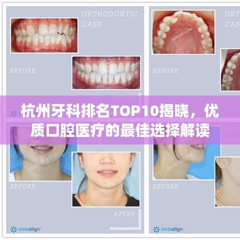杭州牙科排名TOP10揭曉，優(yōu)質(zhì)口腔醫(yī)療的最佳選擇解讀