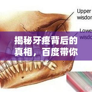 揭秘牙疼背后的真相，百度帶你探索牙疼成因！